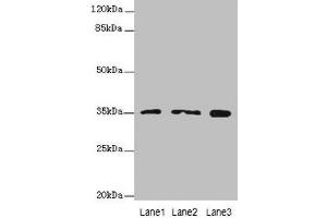 Western blot All lanes: FAHD2A antibody at 0. (FAHD2A Antikörper  (AA 4-314))