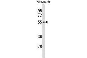 Western blot analysis of ACCN1 Antibody (Center) in NCI-H460 cell line lysates (35 µg/lane). (ACCN1 Antikörper  (Middle Region))