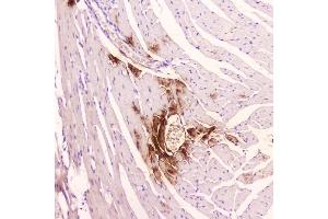 IHC analysis of ANP using anti-ANP antibody (ABIN5693163).