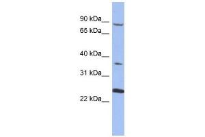 MPP3 antibody used at 1 ug/ml to detect target protein. (MPP3 Antikörper)