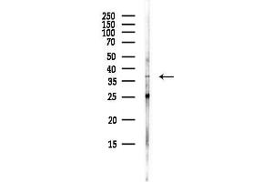 anti-PDZ and LIM Domain 2 (PDLIM2) antibody