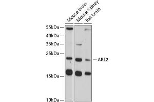 Western blot analysis of extracts of various cell lines, using  antibody (ABIN3016794, ABIN3016795, ABIN3016796 and ABIN6219841) at 1:3000 dilution. (ARL2 Antikörper  (AA 1-184))