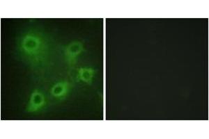 Immunofluorescence analysis of COS7 cells, using SYK (Ab-323) Antibody. (SYK Antikörper  (AA 289-338))