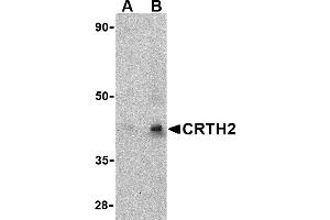 Western blot analysis of CRTH2 in human heart tissue lysate with CRTH2 antibody at (A) 1 and (B) 2 µg/mL. (Prostaglandin D2 Receptor 2 (PTGDR2) (Middle Region) Antikörper)