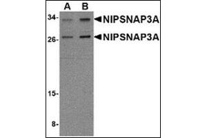 Western blot analysis of NIPSNAP3A in mouse brain tissue lysate with NIPSNAP3A antibody at (A) 0. (NIPSNAP3A Antikörper  (Center))