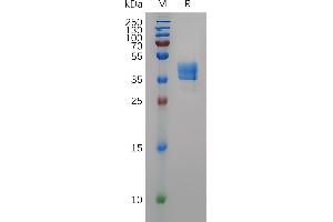SDS-PAGE (SDS) image for Chemokine (C-C Motif) Receptor 8 (CCR8) (AA 1-33) protein (Fc Tag) (ABIN7490803)