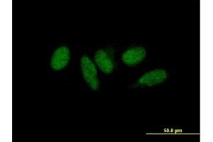Immunofluorescence of purified MaxPab antibody to MED9 on HeLa cell. (MED9 Antikörper  (AA 1-146))