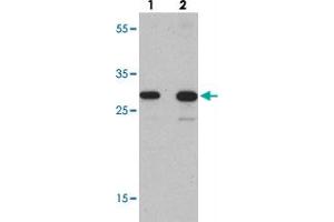 Western blot analysis of TLX3 in human spleen tissue with TLX3 polyclonal antibody  at (lane 1) 0. (TLX3 Antikörper  (N-Term))