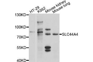 Western blot analysis of extracts of various cell lines, using SLC44A4 antibody (ABIN4905203) at 1:1000 dilution. (SLC44A4 Antikörper)
