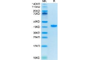 Human TFF1 on Tris-Bis PAGE under reduced condition. (TFF1 Protein (AA 25-84) (Fc Tag))
