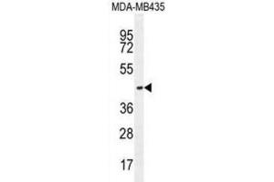 Western Blotting (WB) image for anti-Olfactory Receptor, Family 2, Subfamily L, Member 13 (OR2L13) antibody (ABIN2996118) (OR2L13 Antikörper)