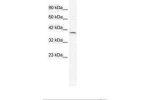 Image no. 1 for anti-Gastrulation Brain Homeo Box 2 (GBX2) (AA 181-230) antibody (ABIN202301) (GBX2 Antikörper  (AA 181-230))