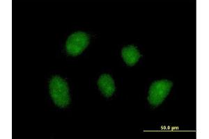 Immunofluorescence of purified MaxPab antibody to ZNF710 on HeLa cell. (ZNF710 Antikörper  (AA 1-664))