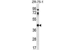 CTSO Antibody (N-term) western blot analysis in ZR-75-1 cell line lysates (35µg/lane).