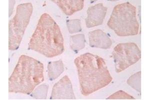 IHC-P analysis of Rat Skeletal Muscle Tissue, with DAB staining. (Endoglin Antikörper  (AA 26-136))