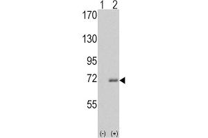 Western blot analysis of IRAK1 (arrow) using rabbit polyclonal IRAK Antibody (C-term). (IRAK1 Antikörper)