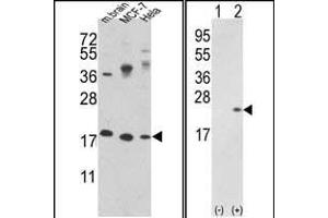 Western blot analysis of CFL1 Antibody (N-term) (ABIN389443 and ABIN2839515) in MCF-7,Hela cell line and mouse brain tissue lysates (35 μg/lane). (Cofilin Antikörper  (N-Term))