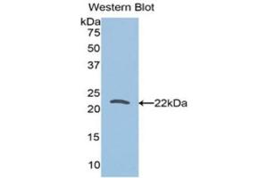 Western Blotting (WB) image for anti-Tumor Protein, Translationally-Controlled 1 (TPT1) (AA 1-172) antibody (ABIN1860852) (TPT1 Antikörper  (AA 1-172))