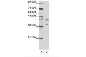 Image no. 2 for anti-Heterogeneous Nuclear Ribonucleoprotein K (HNRNPK) (AA 371-420) antibody (ABIN203155) (HNRNPK Antikörper  (AA 371-420))