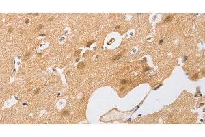 Immunohistochemistry of paraffin-embedded Human brain tissue using CEBP beta Polyclonal Antibody at dilution 1:60 (CEBPB Antikörper)