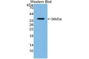 Western Blotting (WB) image for anti-5'-Nucleotidase, Cytosolic III (NT5C3) (AA 52-336) antibody (ABIN1980362)