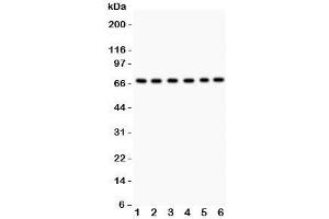 Western blot testing of PKC iota antibody and Lane 1:  SHG-44;  2: A549;  3: U87;  4: 293T;  5: HeLa;  6: Jurkat. (PKC iota Antikörper  (AA 21-214))