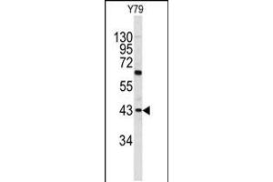 Western blot analysis of PRELP antibody in Y79 cell line lysates (35ug/lane) (PRELP Antikörper  (C-Term))