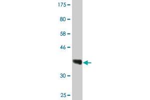 Western Blot detection against Immunogen (36. (RPRD1A Antikörper  (AA 76-170))