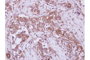 Immunohistochemistry (IHC) image for anti-Purinergic Receptor P2X, Ligand-Gated Ion Channel, 7 (P2RX7) (Center) antibody (ABIN2855803)
