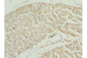 Immunohistochemistry of paraffin-embedded human heart tissue using ABIN7173581 at dilution of 1:100 (TNNI2 Antikörper  (AA 1-100))