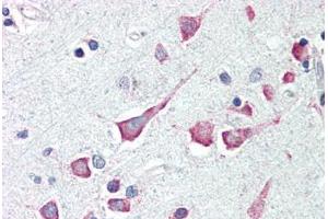 Human Brain, Cortex (formalin-fixed, paraffin-embedded) stained with DAPK3 antibody ABIN214482 at 2. (DAPK3 Antikörper  (Internal Region))