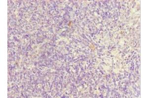 Immunohistochemistry of paraffin-embedded human thymus tissue using ABIN7169185 at dilution of 1:100 (SIK3 Antikörper  (AA 60-310))