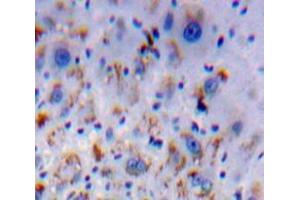 IHC-P analysis of Liver tissue, with DAB staining. (HFE2 Antikörper  (AA 29-401))