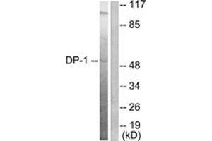 Western blot analysis of extracts from HeLa cells, using DP-1 Antibody. (TGM4 Antikörper  (AA 361-410))