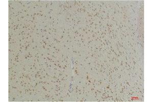 Immunohistochemistry (IHC) analysis of paraffin-embedded Mouse Brain Tissue using GABA Transporter 1 Rabbit Polyclonal Antibody diluted at 1:200. (SLC6A1 Antikörper)