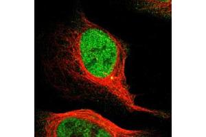 Immunofluorescent staining of U-2 OS with MCM3 polyclonal antibody  (Green) shows positivity in centrosome and nucleus but excluded from the nucleoli. (MCM3 Antikörper)