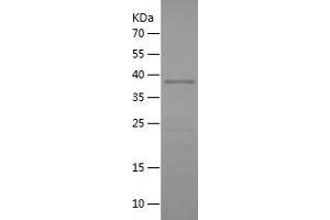 Western Blotting (WB) image for Transforming, Acidic Coiled-Coil Containing Protein 3 (TACC3) (AA 390-689) protein (His tag) (ABIN7283328) (TACC3 Protein (AA 390-689) (His tag))