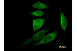 Immunofluorescence of purified MaxPab antibody to TMSB4X on HeLa cell. (TMSB4X Antikörper  (AA 1-44))