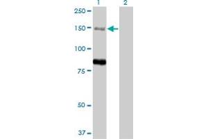 Western Blot analysis of MTMR3 expression in transfected 293T cell line by MTMR3 monoclonal antibody (M07A), clone 1E11. (MTMR3 Antikörper  (AA 579-674))
