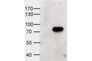 HEK293 overexpressing human ABCD1 and probed with ABIN334339 at 1ug/ml (mock transfection in first lane).