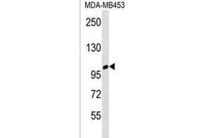 ANKRD20A3 Antibody (C-term) (ABIN1537600 and ABIN2850333) western blot analysis in MDA-M cell line lysates (35 μg/lane). (ANKRD20A3 Antikörper  (C-Term))