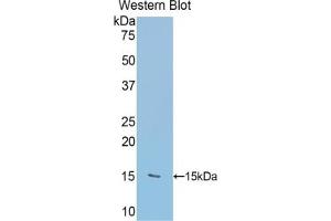 Detection of Recombinant RALBP1, Human using Polyclonal Antibody to RalA Binding Protein 1 (RALBP1) (RALBP1 Antikörper  (AA 403-499))