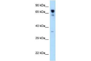 WB Suggested Anti-RARS Antibody Titration: 1. (RARS Antikörper  (C-Term))