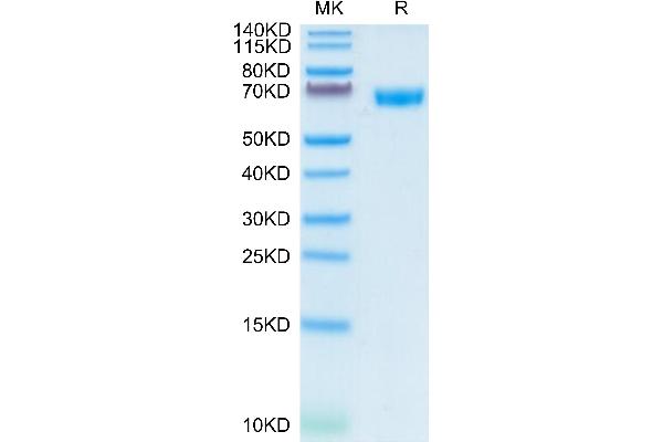 CD200 Protein (CD200) (AA 31-232) (Fc Tag)