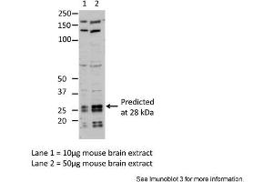 Sample Type: Lane1 = 10ug mouse brain extractLane 2 = 50ug mouse brain extractPrimary Antibody Dilution: Anti-EIF4E 1:1000Submitted By: Dr. (EIF4E Antikörper  (C-Term))