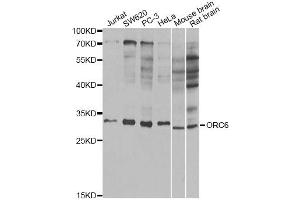 Western blot analysis of extracts of various cell lines, using ORC6 antibody. (ORC6 Antikörper)