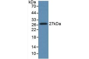 Detection of Recombinant HGF, Human using Monoclonal Antibody to Hepatocyte Growth Factor (HGF) (HGF Antikörper  (AA 495-728))