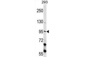 Western Blotting (WB) image for anti-Epithelial Cell Transforming Sequence 2 Oncogene (ECT2) antibody (ABIN2998212) (ECT2 Antikörper)