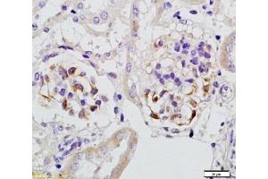 Immunohistochemistry (Paraffin-embedded Sections) (IHC (p)) image for anti-serpin Peptidase Inhibitor, Clade B (Ovalbumin), Member 7 (SERPINB7) (AA 301-380) antibody (ABIN728548)
