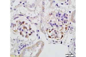 Formalin-fixed and paraffin embedded rat kidney tissue with Anti-Megsin Polyclonal Antibody, Unconjugated  at 1:200, followed by conjugation to the secondary antibody and DAB staining (SERPINB7 Antikörper  (AA 301-380))